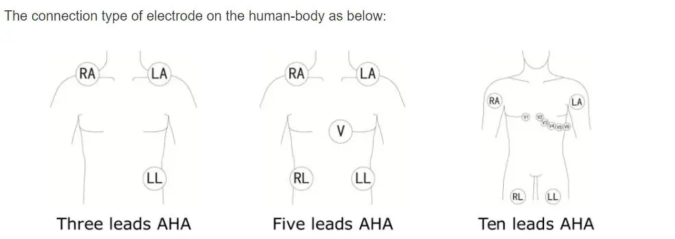 5 οδηγοί ΗΚΓ για το philips digitrak plus 24 ώρες ολλανδικός 3100A, 5-lead, Snap